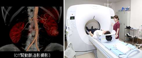 (CT腎動脈造影撮影)